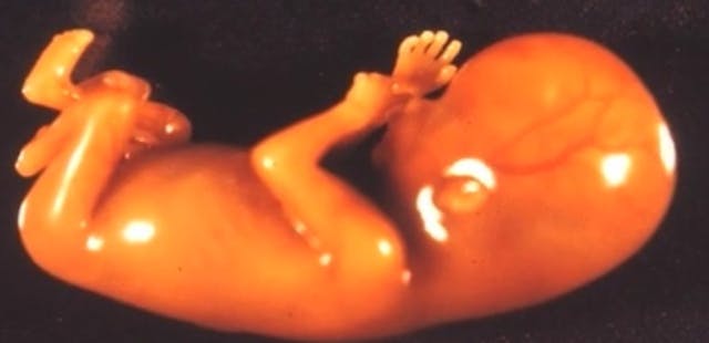 How one photo of a preborn baby helped to make future generations pro-life image