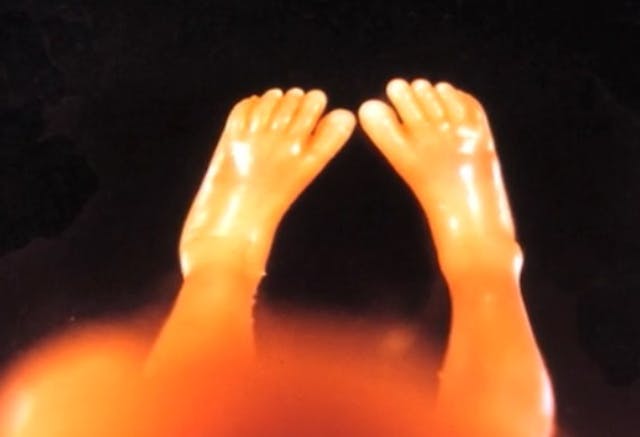 How one photo of a preborn baby helped to make future generations pro-life image