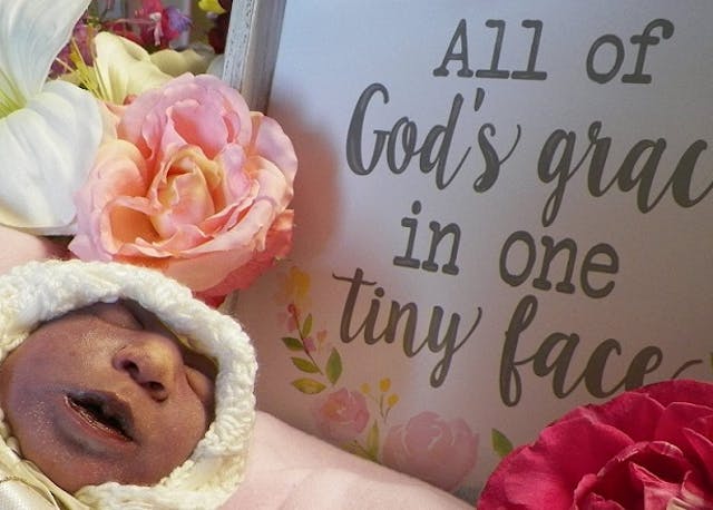 Miriam Grace (Photo courtesy of Mahner family) Baby Miriam’s story is showing the world that even short lives are worth living image