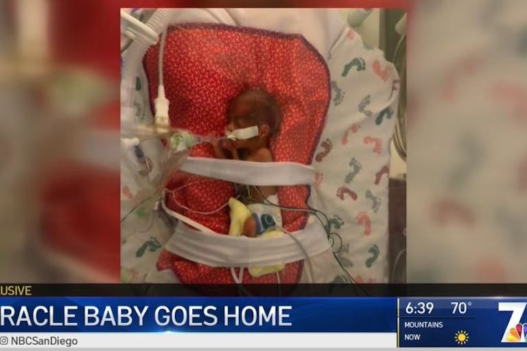 premature, 22 weeks, screenshot, micro-preemie