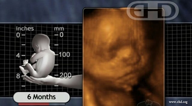 Born at 6 months and weighing just 13 ounces, Dylan is a ‘fighter’ who just celebrated his first birthday image