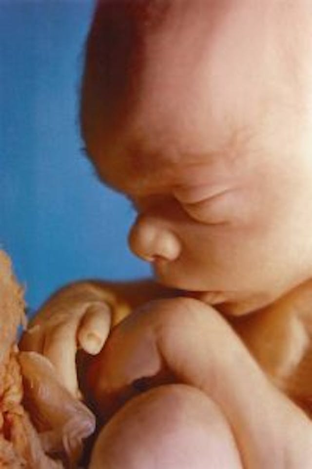 20 week old preborn baby Planned Parenthood’s talking points on 20-week abortions are not to be trusted image