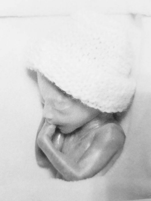 Mother shares photo of daughter born at 21 weeks: My baby was not a ‘clump of cells’ image