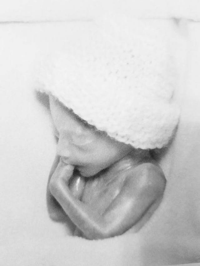 Mother shares photo of daughter born at 21 weeks: My baby was not a ‘clump of cells’ image