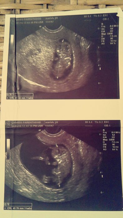 I was coerced into an abortion at Planned Parenthood by my baby’s father, and I wish I could go back and undo it image