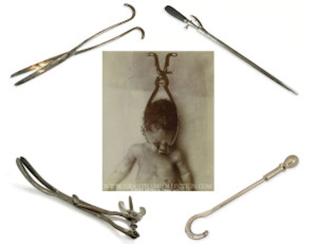 4-instruments-babyinforcep
