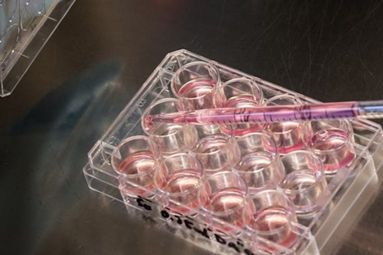 fetal tissue stem cells bioethics