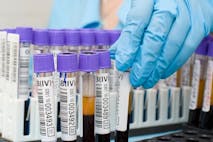 blood-test