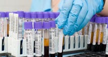 blood-test