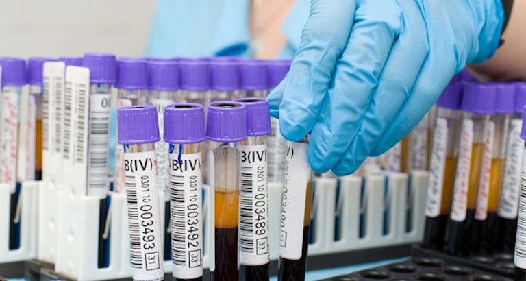 blood-test
