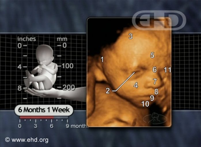 Abortionist on trial after woman bled to death from late-term abortion image