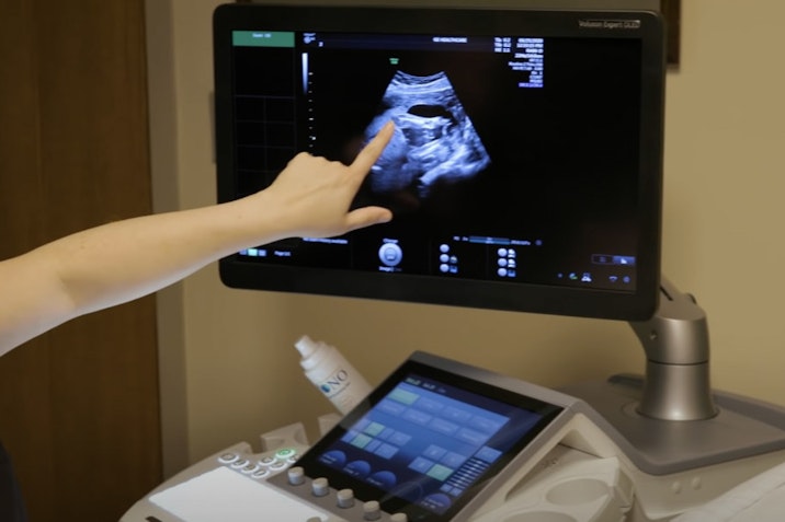 pregnancy centers, ultrasound