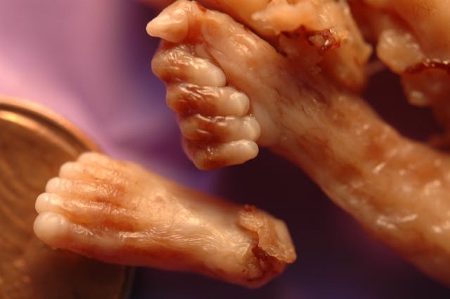 Contrary to popular belief, late-term abortions aren’t always done for medical reasons image