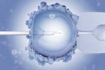 via flicker, IVF