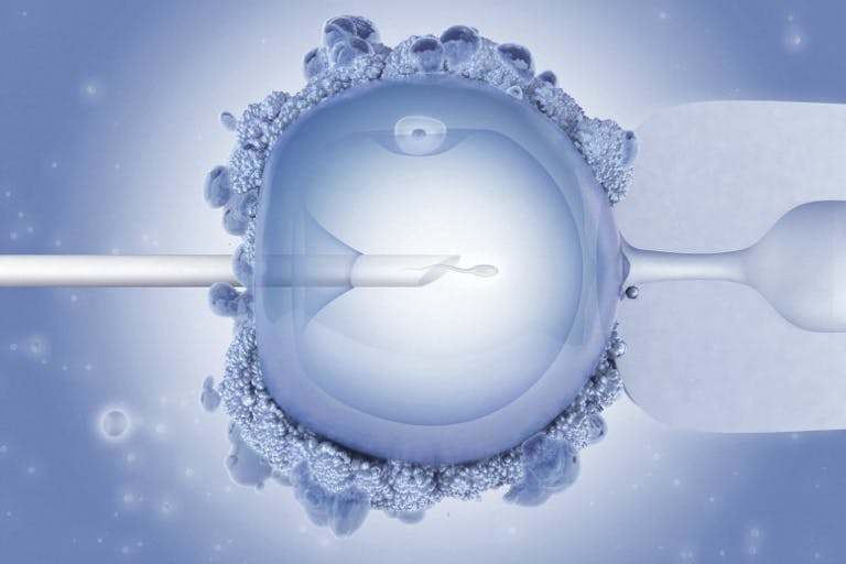via flicker, IVF