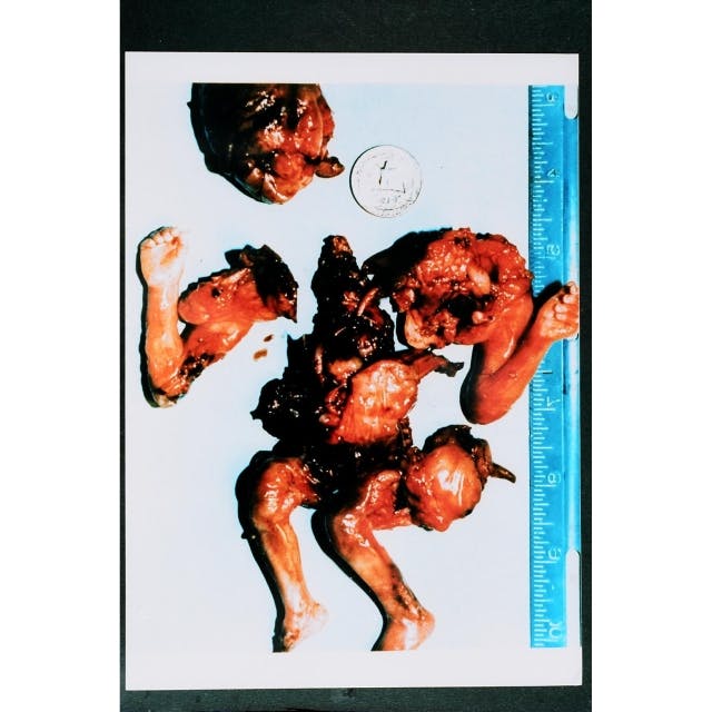 11 powerful images that may change your mind about abortion image