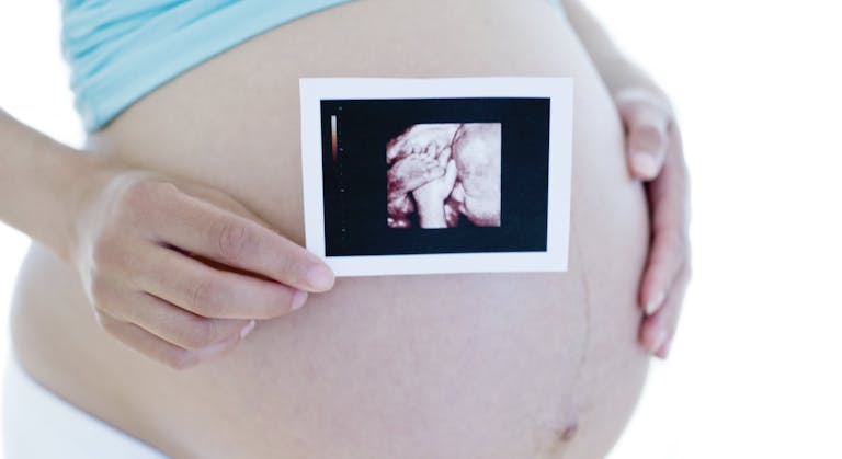 Pregnant woman holding her baby scan