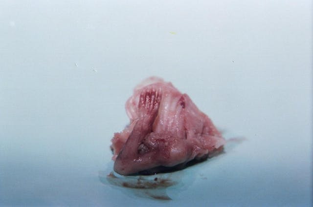 Abortion is violence: Words and videos from inside the abortion industry image