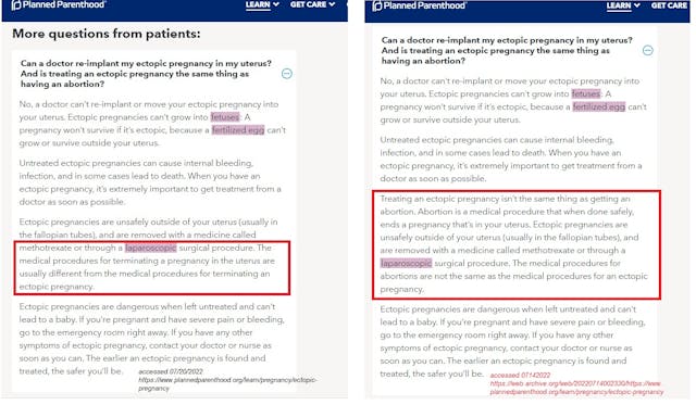 Image: Planned Parenthood ectopic pregnancy language change side by side (Accessed July 14 v July 20 of 2022)