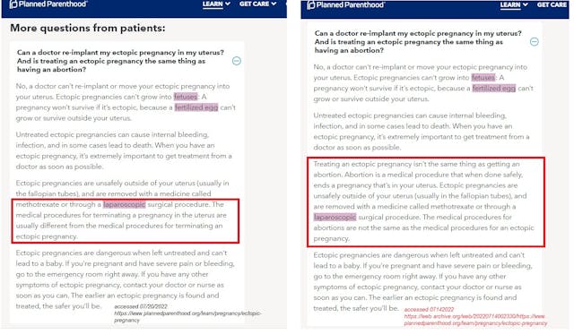 Planned Parenthood ectopic pregnancy language change side by side (Accessed July 14 v July 20 of 2022) Image: Planned Parenthood ectopic pregnancy language change side by side (Accessed July 14 v July 20 of 2022)