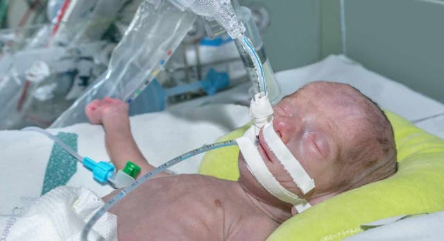 preemie, abortion,