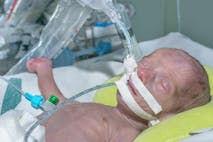 preemie, abortion,