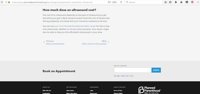 Planned Parenthood’s claims about ‘free’ ultrasounds are a sham image
