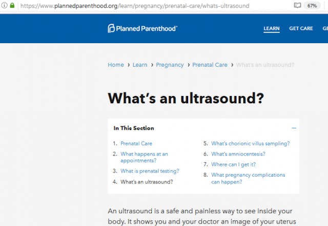 Planned Parenthood’s claims about ‘free’ ultrasounds are a sham image