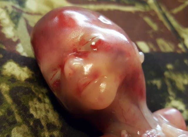 Mother shares photos of baby miscarried at 14 weeks: ‘He is very obviously human’ image