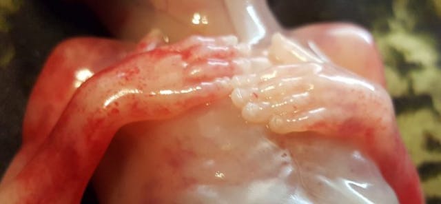 Baby at 14 weeks, 6 days (Photo by Felicia Cash. Used with permission.) Baby at 14 weeks, 6 days (Photo by Felicia Cash. Used with permission.)