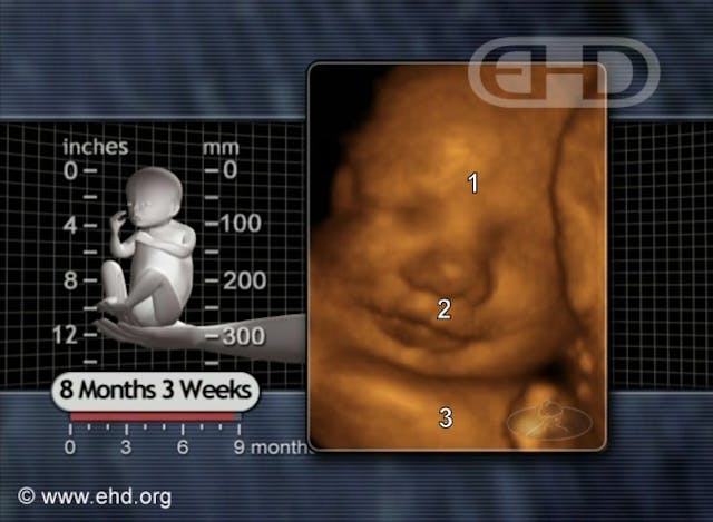 Infant who survived an abortion at 35 weeks saved by nurse who heard baby crying inside plastic bag image