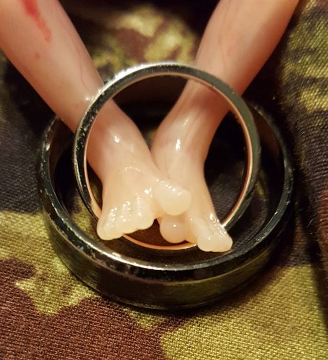 Baby at 14 weeks, 6 days (Photo by Felicia Cash. Used with permission.) Baby at 14 weeks, 6 days (Photo by Felicia Cash. Used with permission.)