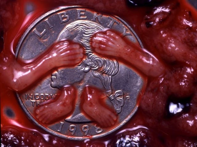 Hands and feet of a 9 week old preborn child killed through an aspiration abortion. French abortion businesses want relaxed abortion restrictions during COVID-19… or they’ll break the law image