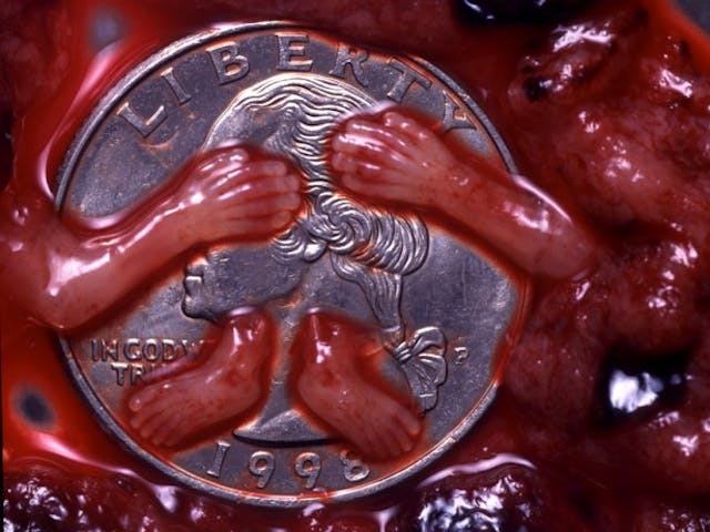 French abortion businesses want relaxed abortion restrictions during COVID-19… or they’ll break the law image