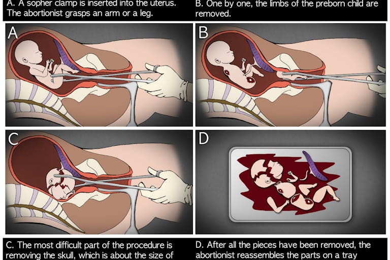 Requests for this procedure at Planned Parenthood were sent to the top of the queue.
