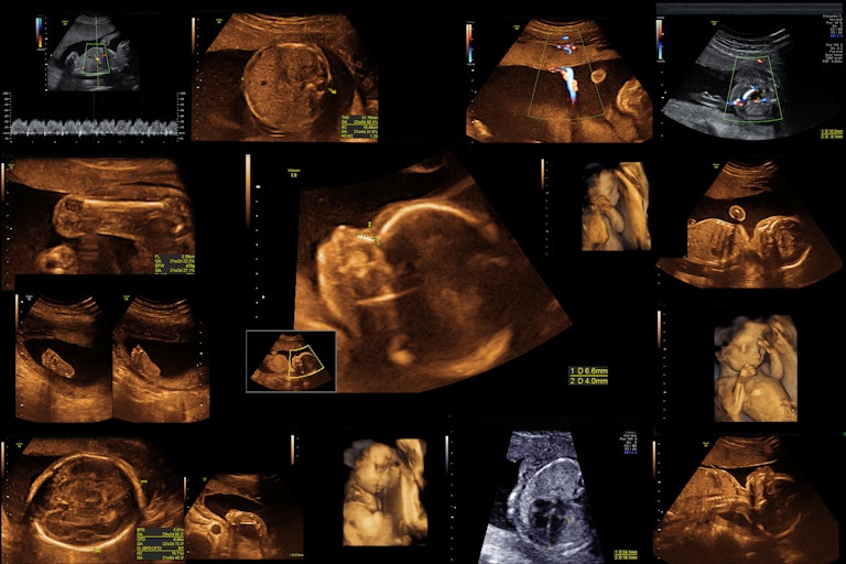 ultrasounds