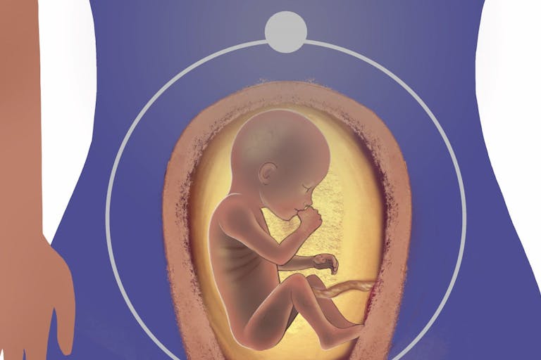 induction abortion screenshot