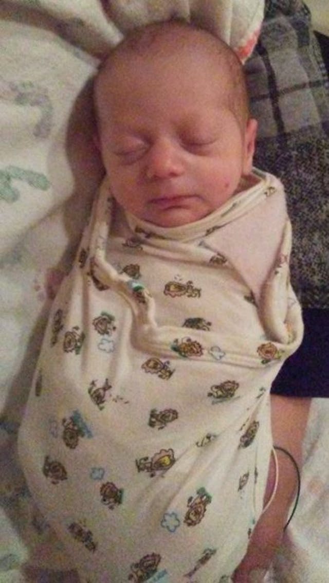 baby saved from abortion