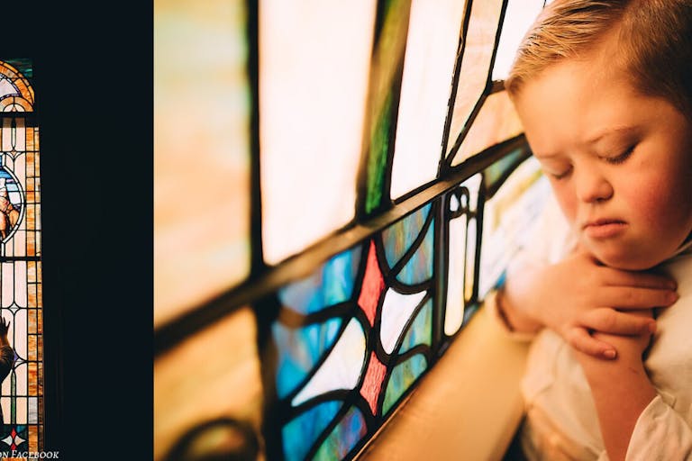 Down syndrome, abortion