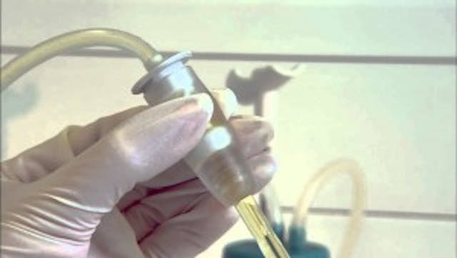 Machine vacuum aspiration maxresdefault