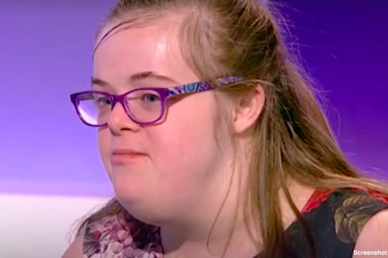 down syndrome
