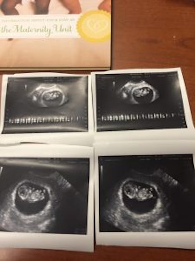 Maddie Runkles prenatal pictures