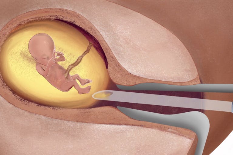 Untitled design (62)