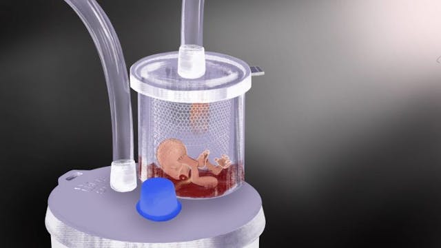 WATCH: Live Action’s new video series exposes what happens in a D&C abortion image
