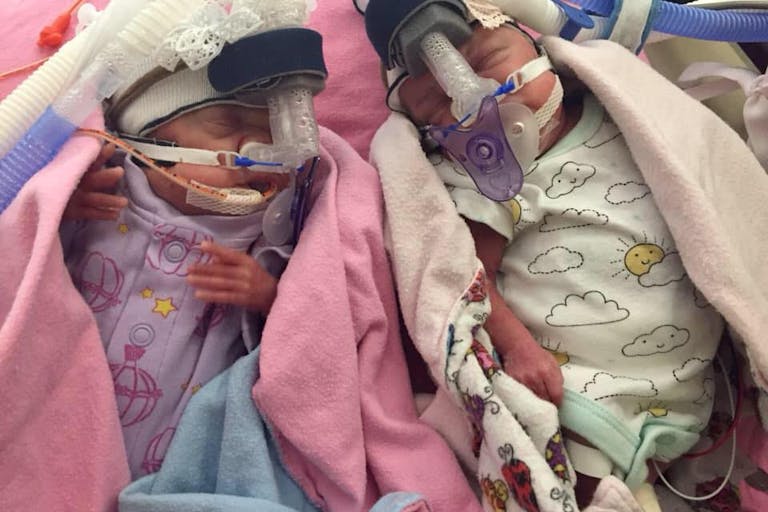 via Facebook, premature, twins, 22 weeks