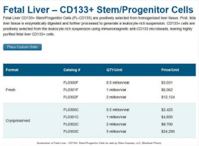 Stem Express, Planned Parenthood, liver, baby parts