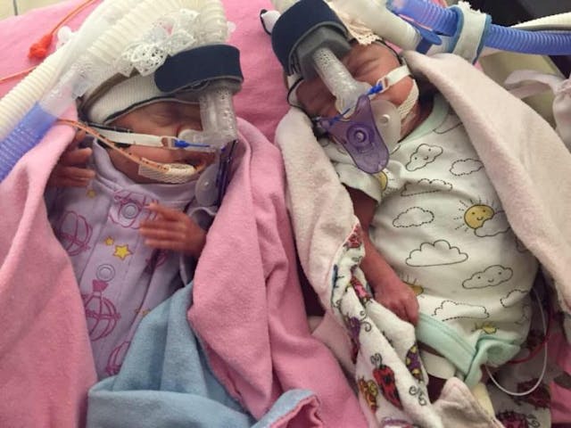 via Facebook. via Facebook, premature, twins, 22 weeks