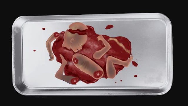 WATCH: Live Action’s new video series shows the horrifying reality of a D&E abortion image