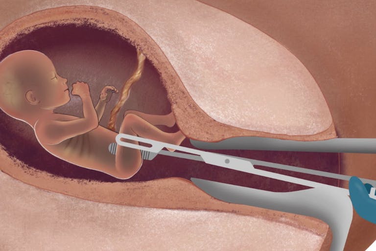 Untitled design (61)