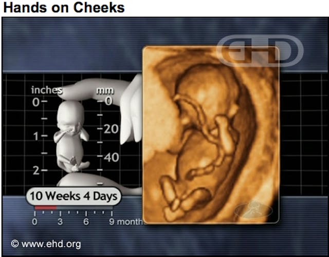 10 weeks Man leaving Carhart abortion facility with biohazard bag: ‘It’s a fetus’ image